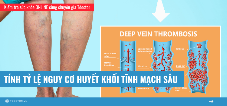 Tính tỷ lệ nguy cơ huyết khối tĩnh mạch sâu